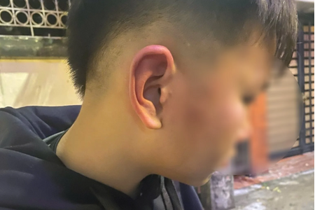 Công an xác minh nghi vấn bé trai ở Hà Nội bị bố của bạn hành hung khi đến nhà bạn học chơi