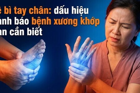 Tê bì tay chân: dấu hiệu cảnh báo bệnh xương khớp bạn cần biết