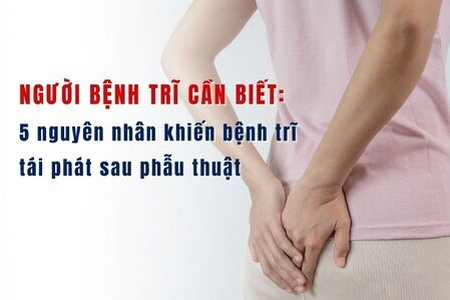 5 nguyên nhân khiến bệnh trĩ tái phát sau phẫu thuật