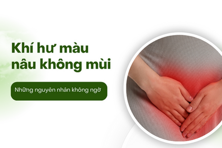 Khí hư màu nâu không mùi: Những nguyên nhân không ngờ