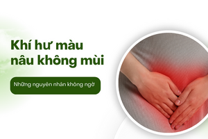 Khí hư màu nâu không mùi: Những nguyên nhân không ngờ