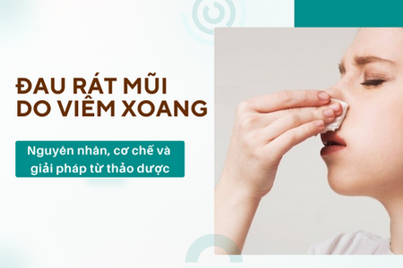 Đau rát mũi do viêm xoang: Nguyên nhân, cơ chế và giải pháp