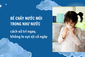 Bé chảy nước mũi trong như nước: cách xử trí ngay, không lo sụt sịt
