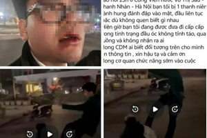 Truy tìm đối tượng hành hung nam thanh niên gây mất nhận thức tại 1 công viên ở Hà Nội