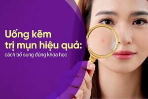 Uống kẽm trị mụn hiệu quả: cách bổ sung đúng khoa học