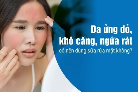 Da ửng đỏ, khô căng, ngứa rát có nên dùng sữa rửa mặt không?