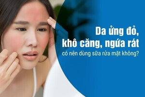 Da ửng đỏ, khô căng, ngứa rát có nên dùng sữa rửa mặt không?