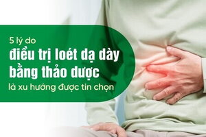 5 lý do điều trị loét dạ dày bằng thảo dược là xu hướng được tin chọn