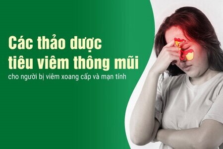 Các thảo dược tiêu viêm thông mũi cho người bị viêm xoang cấpmạn tính