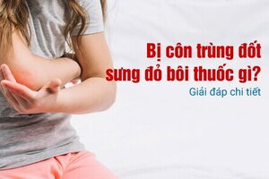 Bị côn trùng đốt sưng đỏ bôi thuốc gì? Giải đáp chi tiết