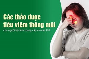 Các thảo dược tiêu viêm thông mũi cho người bị viêm xoang cấpmạn tính