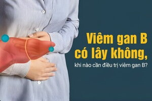 Viêm gan B có lây không, khi nào cần điều trị viêm gan B?
