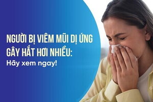 Người bị viêm mũi dị ứng gây hắt hơi nhiều: Hãy xem ngay!