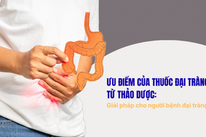 Ưu điểm của thuốc đại tràng từ thảo dược giải pháp cho bệnh đại tràng