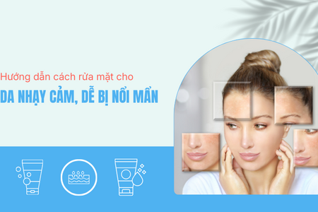 Hướng dẫn cách rửa mặt cho da nhạy cảm, dễ bị nổi mẩn