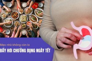 Mẹo nhỏ không còn lo đầy hơi chướng bụng ngày Tết