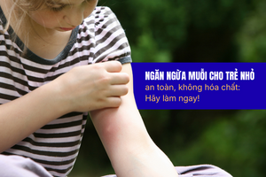 Ngăn ngừa muỗi cho trẻ nhỏ an toàn, không hóa chất: hãy làm ngay!