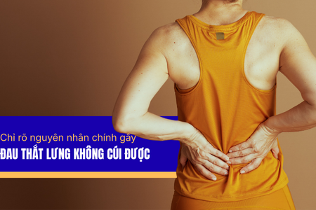Chỉ rõ nguyên nhân chính gây đau thắt lưng không cúi được