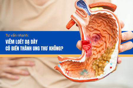 Tư vấn nhanh: Viêm loét dạ dày có biến thành ung thư không?