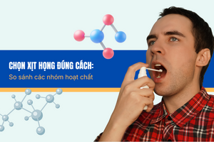 Chọn xịt họng đúng cách: So sánh các nhóm hoạt chất