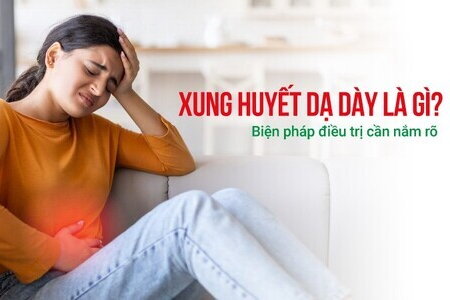 Xung huyết dạ dày là gì? Biện pháp điều trị cần nắm rõ