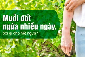 Muỗi đốt ngứa nhiều ngày, bôi gì cho hết ngứa?