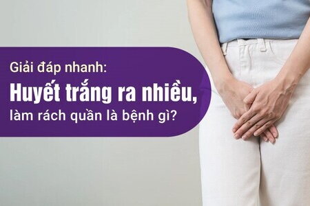Giải đáp nhanh: Huyết trắng ra nhiều, làm rách quần là bệnh gì?