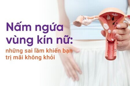 Nấm ngứa vùng kín nữ: những sai lầm khiến bạn trị mãi không khỏi
