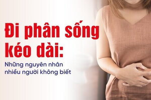 Đi phân sống kéo dài: Những nguyên nhân nhiều người không biết