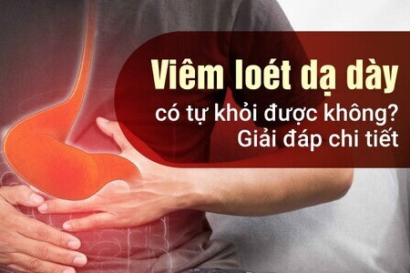 Viêm loét dạ dày có tự khỏi được không? Giải đáp chi tiết