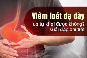 Viêm loét dạ dày có tự khỏi được không? Giải đáp chi tiết