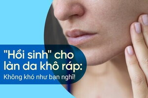 "Hồi sinh" cho làn da khô ráp: Không khó như bạn nghĩ!