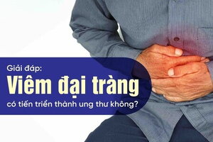 Giải đáp: Viêm đại tràng có tiến triển thành ung thư không?