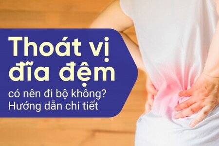 Thoát vị đĩa đệm có nên đi bộ không? Hướng dẫn chi tiết