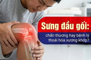 Sưng đầu gối: chấn thương hay bệnh lý thoái hóa xương khớp?