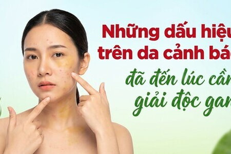 Những dấu hiệu trên da cảnh báo đã đến lúc cần giải độc gan