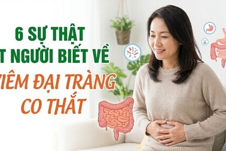 6 sự thật ít người biết về viêm đại tràng co thắt