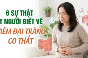 6 sự thật ít người biết về viêm đại tràng co thắt