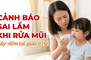 Cảnh báo sai lầm khi rửa mũi gây viêm tai giữa ở trẻ