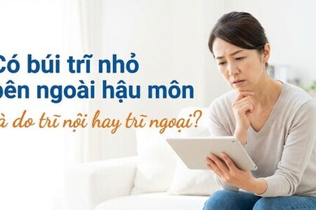 Có búi trĩ nhỏ bên ngoài hậu môn là do trĩ nội hay trĩ ngoại?