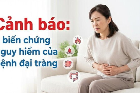 Cảnh báo: 5 biến chứng nguy hiểm của bệnh đại tràng
