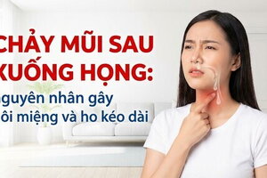 Chảy mũi sau xuống họng: nguyên nhân gây hôi miệng và ho kéo dài