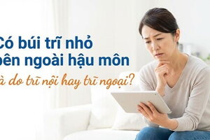 Có búi trĩ nhỏ bên ngoài hậu môn là do trĩ nội hay trĩ ngoại?