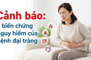 Cảnh báo: 5 biến chứng nguy hiểm của bệnh đại tràng