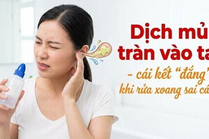 Dịch mủ tràn vào tai - cái kết "đắng" khi rửa xoang sai cách