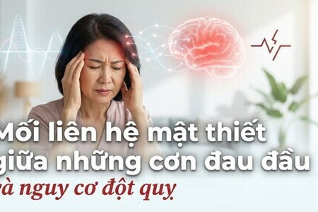 Mối liên hệ mật thiết giữa những cơn đau đầu và nguy cơ đột quỵ