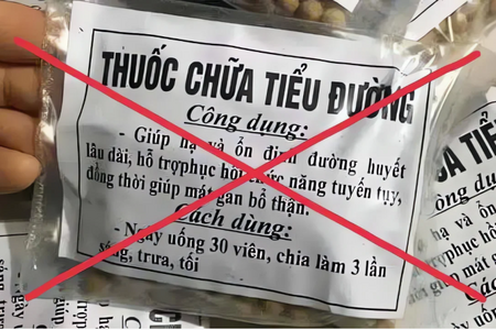 Mặt tròn xoe, suy yếu sau khi dùng thuốc không rõ nguồn gốc để "giảm đau xương khớp nhanh"