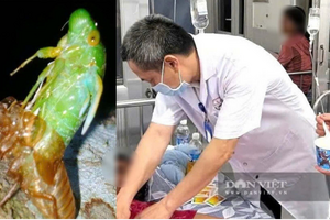 Ngộ độc ve sầu diễn biến phức tạp, bệnh viện ở Quảng Trị cảnh báo người dân