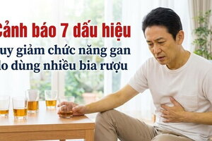 Cảnh báo 7 dấu hiệu suy giảm chức năng gan do dùng nhiều bia rượu