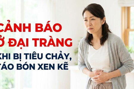 Cảnh báo ở đại tràng khi bị tiêu chảy, táo bón xen kẽ